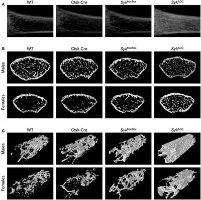 Hematopoietic or Osteoclast-Specific Deletion of Syk Leads to Increased Bone Mass in Experimental Mice